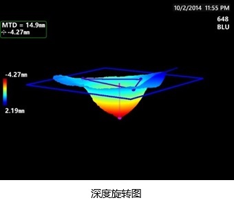 3DPM-深度旋轉圖